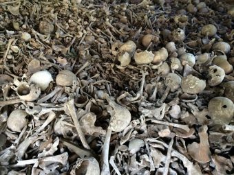 general photograph of bones