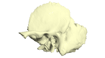 Digital rendering of a temporal bone, which is in the skull. It is mostly flat, and rounded at the top. It has a large, rounded, angled portion that sticks out of the bottom right. There is a smaller arm that starts in the middle and goes to the left. There is a hole (the ear canal) that is centered in the middle of the bone.