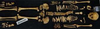 A full archaeological skeleton laid out on a black background in anatomical position
