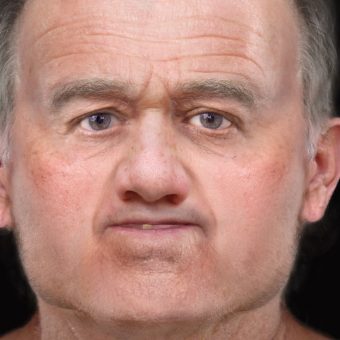 An older man's face digitally reconstructed